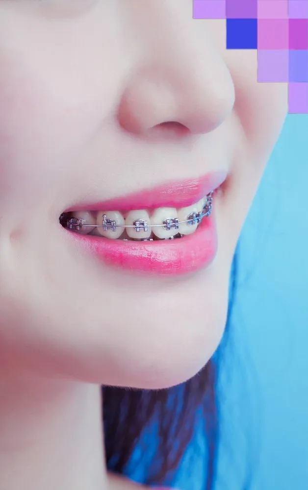 Virtual assistants trained on ortho PMS